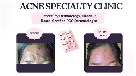 Dermatologists in Mandaue .